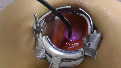 Anal Cam